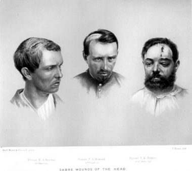 Saber wounds (The use of the sword in the Great War: Faded glory or deadly efficiency?)