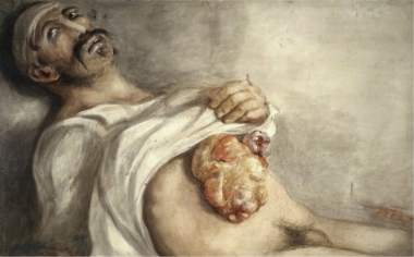 wounded in the abdomen (The use of the sword in the Great War: Faded glory or deadly efficiency?) wounded in the abdomen (The use of the sword in the Great War: Faded glory or deadly efficiency?)