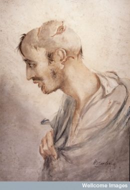 Charles Bell (The use of the saber in the army of Napoleon: Part IV – Wounds caused by the saber)